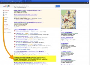 SEO for Dental - SEO Case Study - Pembroke Pines Dental Implants SEO for Dental - SEO Case Study - Pembroke Pines Dental Implants