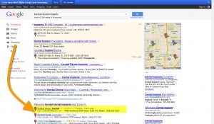 SEO for Dentist - Dental Case Study - Kendall Dental Implants SEO for Dentist - Dental Case Study - Kendall Dental Implants